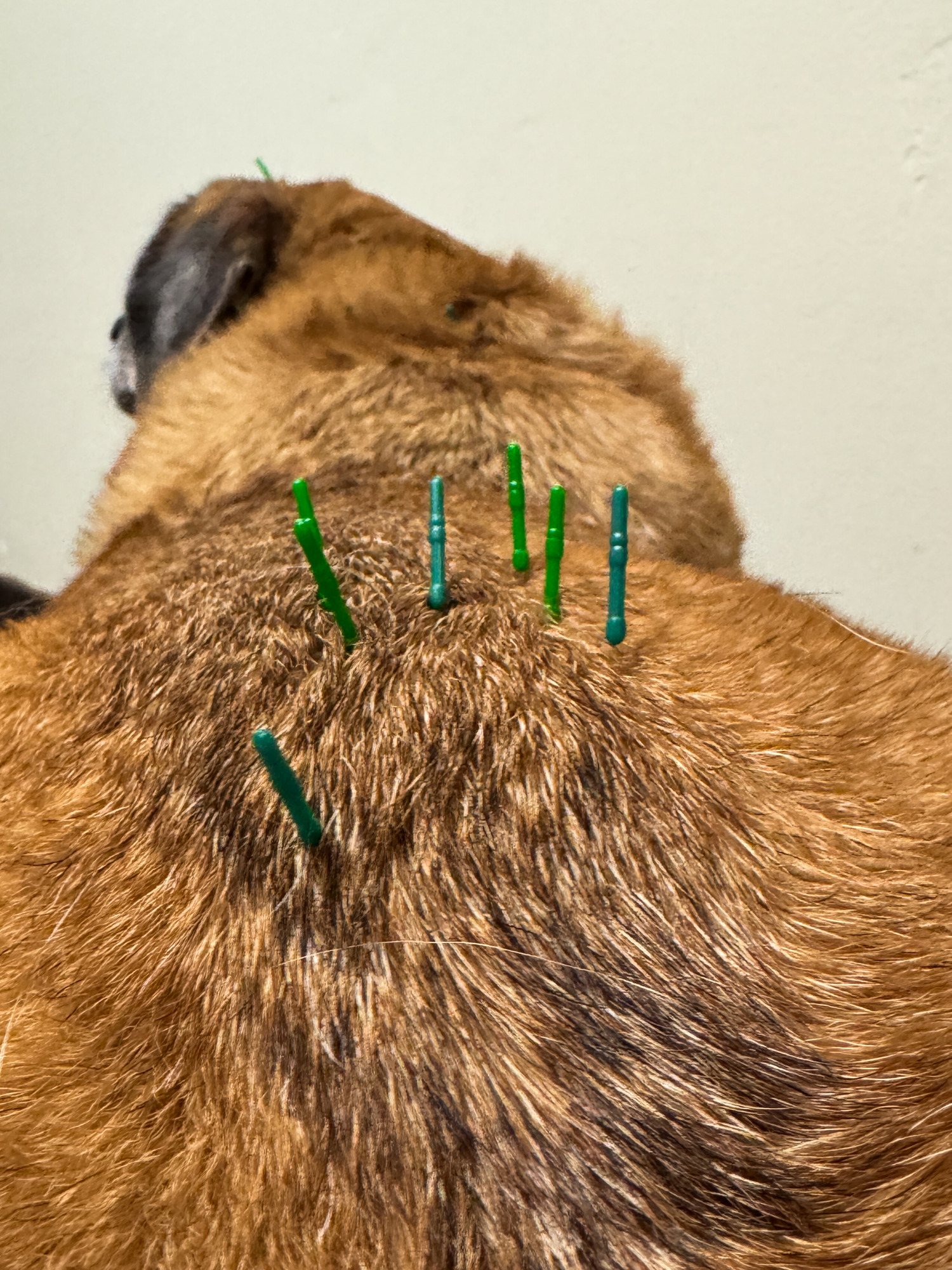 Acupuncture 4