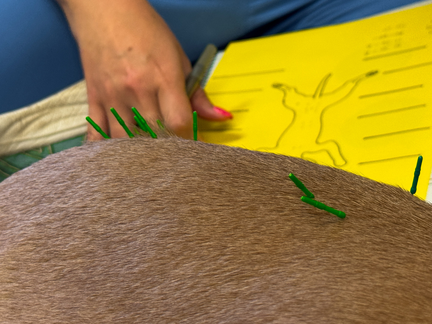 Acupuncture 6