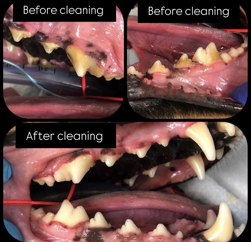 Before and After Dental Cleaning