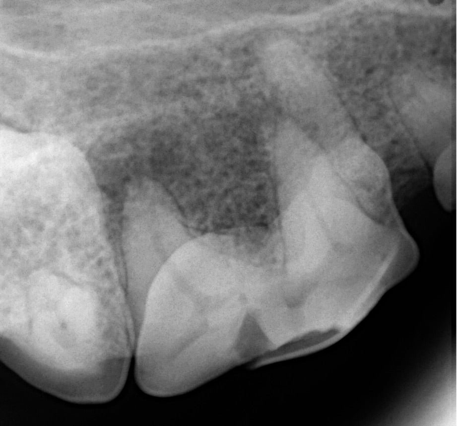 Dental XRay
